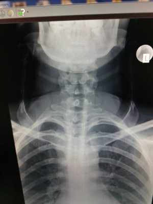 x-ray-1.jpg