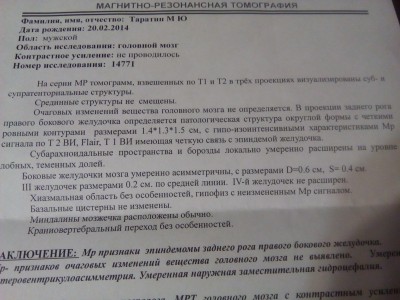 IMG_20161121_183321.jpg (37.65 КБ) 19261 просмотр IMG_20161121_183321.jpg