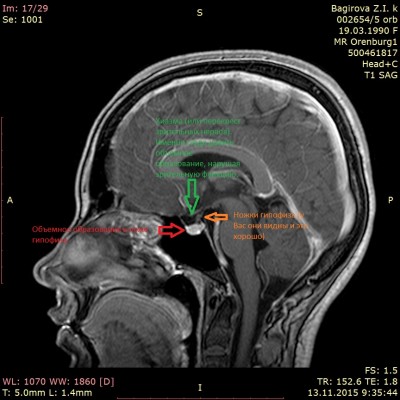 Багирова.jpg (164.91 КБ) 3890 просмотров Багирова.jpg
